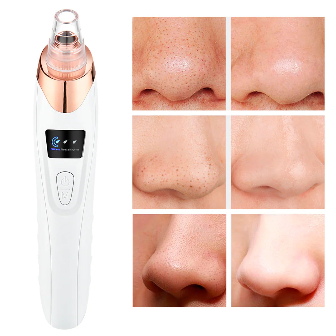 SUCCIONADOR DE PUNTOS NEGROS